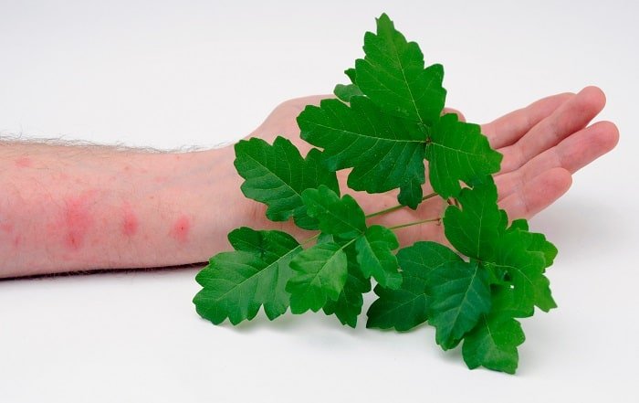 How to Use Coconut Oil for Poison Ivy?